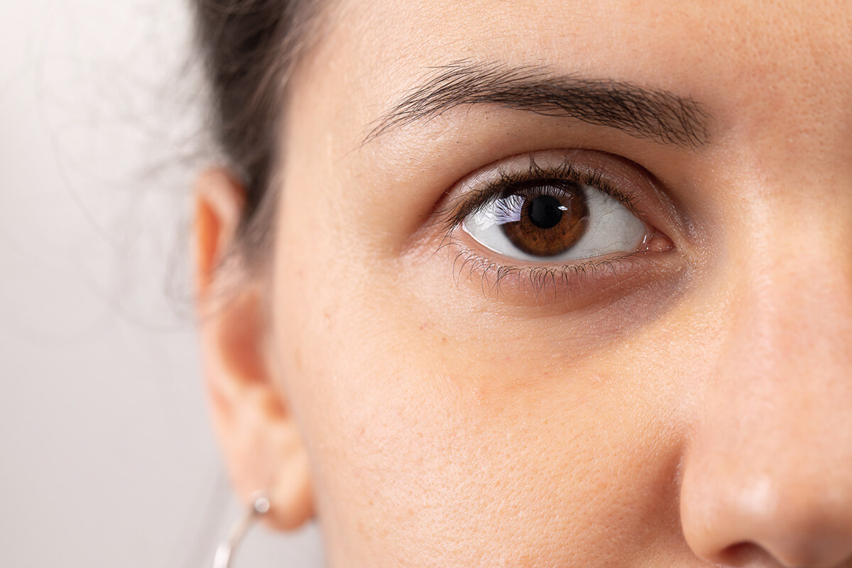 Augenringe loswerden – die besten Tipps und natürlichen Hausmittel