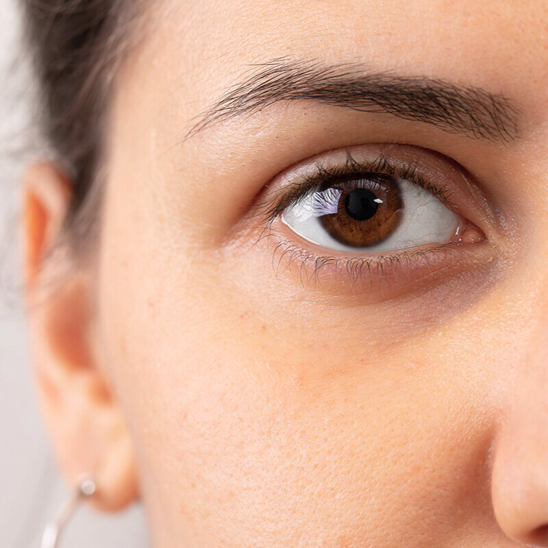 Augenringe loswerden – die besten Tipps und natürlichen Hausmittel